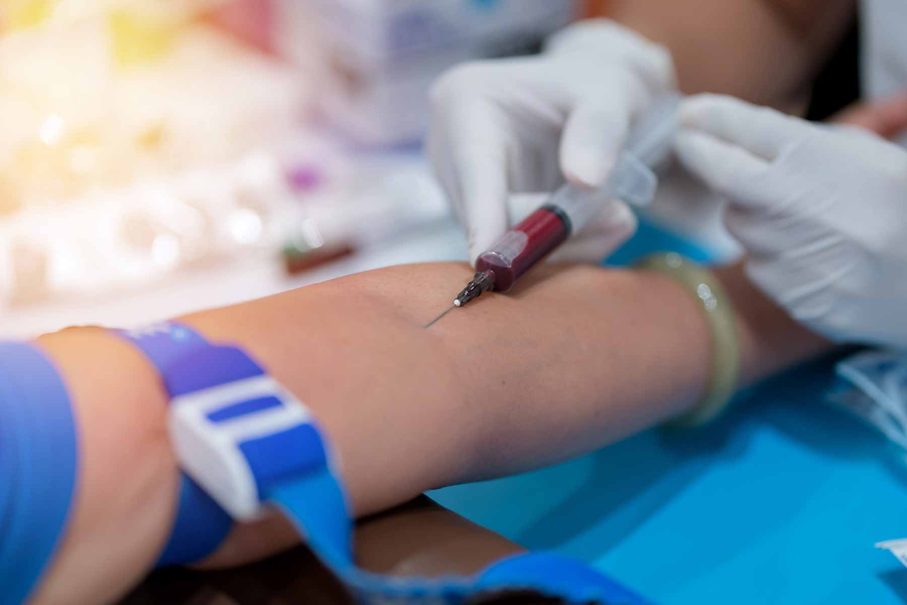 PHLEBOTOMY (GENERAL )